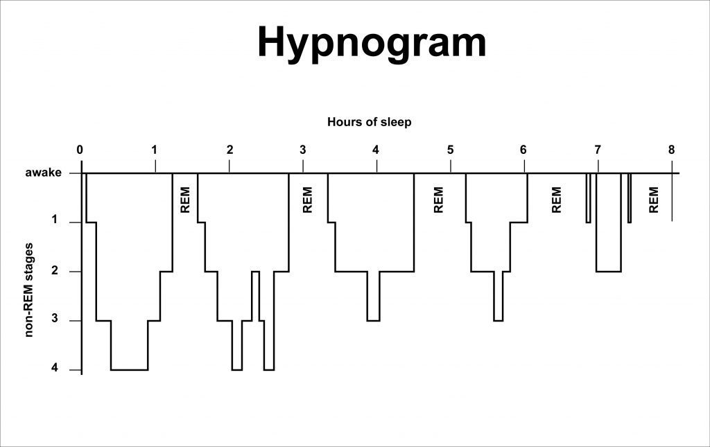 Hypnogram - the sleep cycles over eight hours of sleep